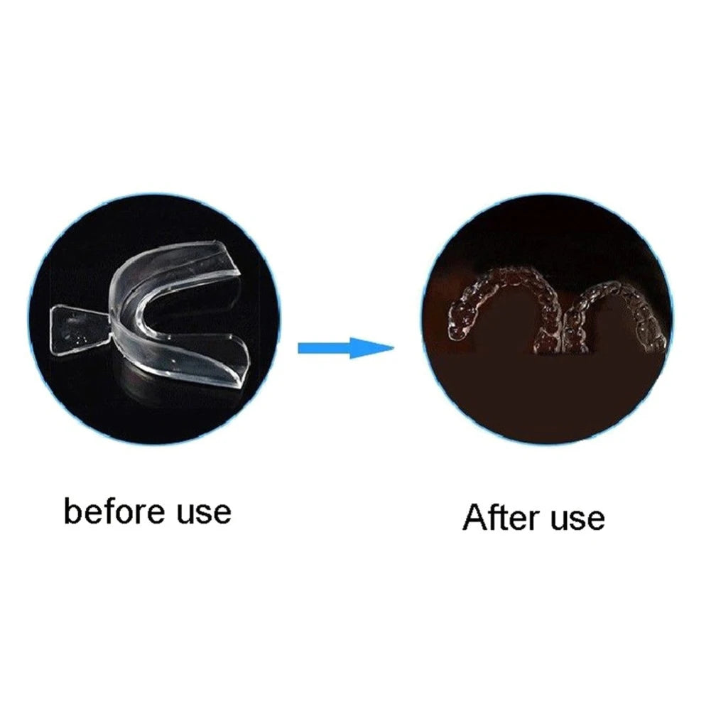 2–8PCS Anti-Snoring Mouth Guard