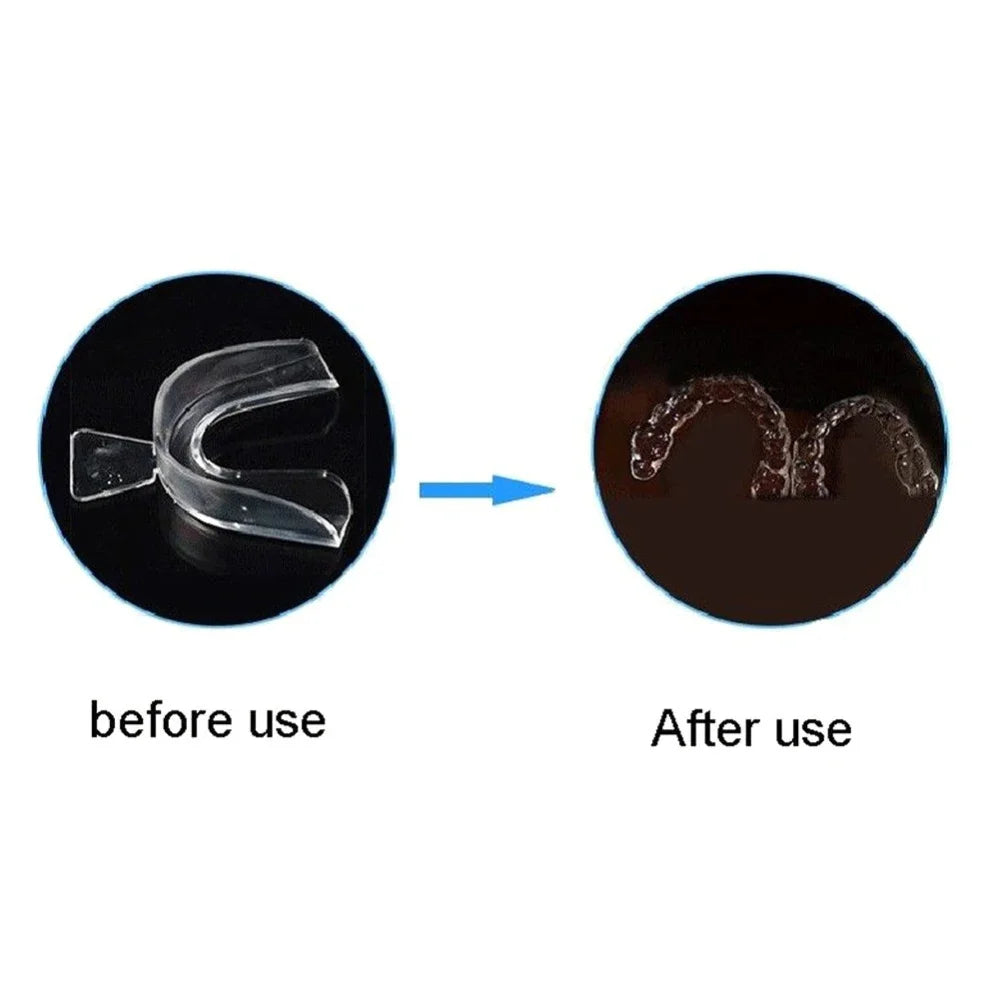 2–8PCS Anti-Snoring Mouth Guard