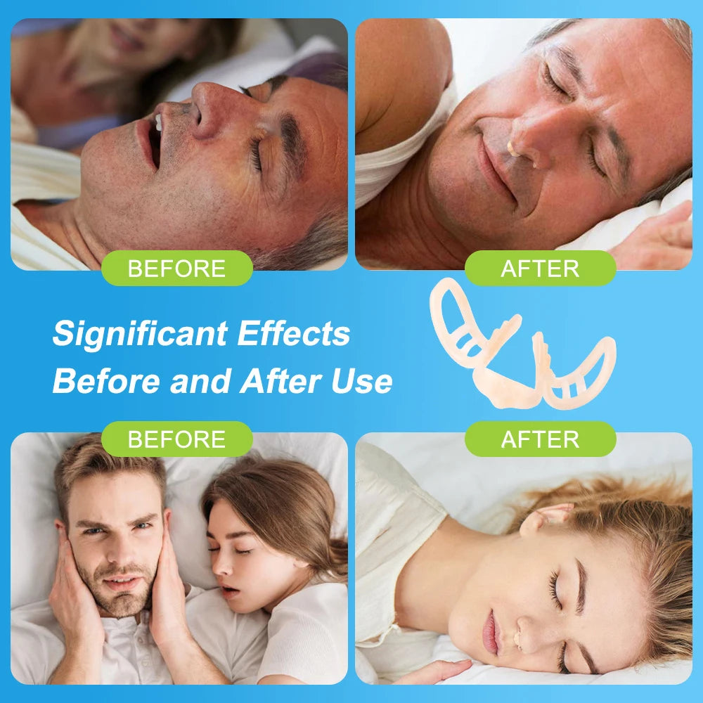 Anti-Snore Nasal Dilator – Silicone Nose Clip for Better Sleep