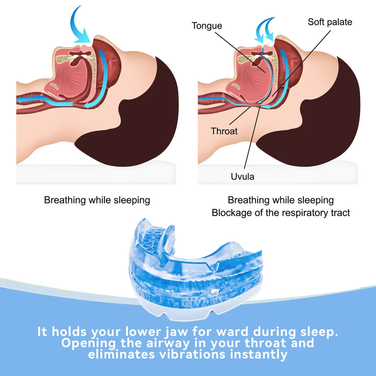 Anti-Snore Bruxism Mouth Guard – Sleep Apnea & Teeth Grinding Aid